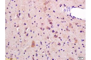 Formalin-fixed and paraffin embedded rat brain labeled with Rabbit Anti JNK2 Polyclonal Antibody, Unconjugated (ABIN681403) at 1:200 followed by conjugation to the secondary antibody and DAB staining (JNK1/2 anticorps  (AA 311-424))