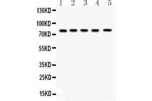 Western blot analysis of FSH Receptor expression in rat testis extract ( Lane 1), rat ovary extract ( Lane 2), mouse testis extract ( Lane 3) mouse ovary extract ( Lane 4) and HELA whole cell lysates ( Lane 5). (FSHR anticorps  (AA 18-187))