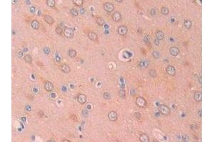 Detection of CA12 in Rat Cerebrum Tissue using Polyclonal Antibody to Carbonic Anhydrase XII (CA12)