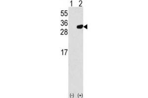 Western Blotting (WB) image for anti-Peroxiredoxin 6 (PRDX6) antibody (ABIN3001723) (Peroxiredoxin 6 anticorps)