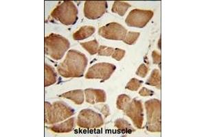 Formalin-fixed and paraffin-embedded human skeletal muscle reacted with NRP1 Antibody (C-term), which was peroxidase-conjugated to the secondary antibody, followed by DAB staining. (Neuropilin 1 anticorps  (C-Term))