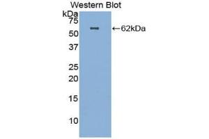 Detection of Recombinant HGF, Human using Polyclonal Antibody to Hepatocyte Growth Factor (HGF)