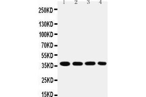 Anti-MTCO1 antibody,  Western blotting Lane 1: SMMC Cell Lysate Lane 2: MCF-7 Cell Lysate Lane 3: RAJI Cell Lysate Lane 4: SW620 Cell Lysate