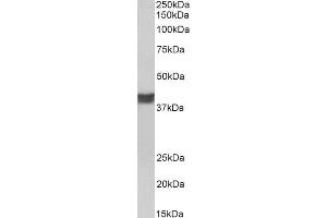 ABIN5539507 (0. (Cardiac Troponin T2 anticorps  (C-Term))