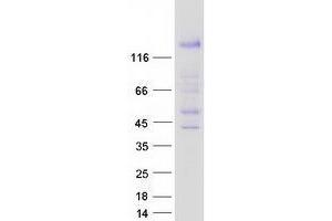Validation with Western Blot