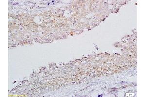 Formalin-fixed and paraffin embedded rat ovary tissue labeled with Rabbit Anti-FSH receptor Polyclonal Antibody, Unconjugated  1:200 followed by conjugation to the secondary antibody and DAB staining.