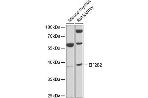 Western blot analysis of extracts of various cell lines, using EIF2B2 antibody (ABIN6132131, ABIN6140037, ABIN6140038 and ABIN6222805) at 1:1000 dilution.