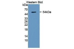 Western Blotting (WB) image for anti-Transmembrane Protein 27 (TMEM27) (AA 15-141) antibody (ABIN1871658) (TMEM27 anticorps  (AA 15-141))