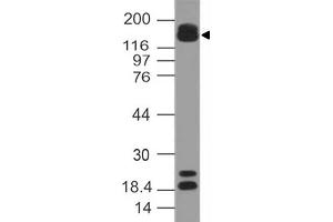 Image no. 1 for anti-AT Rich Interactive Domain 5B (MRF1-Like) (ARID5B) (AA 430-621) antibody (ABIN5027366)