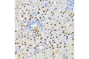Immunohistochemistry of paraffin-embedded mouse kidney using EL antibody (ABIN6132052, ABIN6140108, ABIN6140109 and ABIN6222942) at dilution of 1:200 (40x lens). (ELAC2 anticorps  (AA 1-270))
