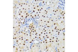 Immunohistochemistry of paraffin-embedded mouse kidney using EL antibody (ABIN6132052, ABIN6140108, ABIN6140109 and ABIN6222942) at dilution of 1:200 (40x lens). (ELAC2 anticorps  (AA 1-270))