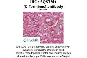 Image no. 1 for anti-Sequestosome 1 (SQSTM1) (C-Term) antibody (ABIN1739629) (SQSTM1 anticorps  (C-Term))