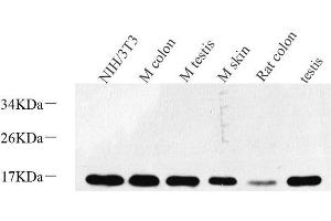 Western Blot analysis of various samples using Survivin Polyclonal Antibody at dilution of 1:600. (Survivin anticorps)