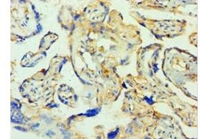 Immunohistochemistry of paraffin-embedded human placenta tissue using ABIN7171585 at dilution of 1:100 (TTBK2 anticorps  (AA 1185-1244))