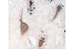 IHC analysis of FFPE human brain tissue stained with PGP9.