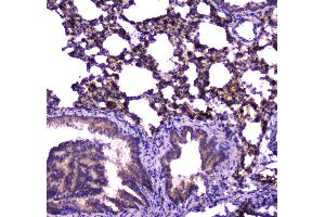 IHC analysis of FABP5 using anti-FABP5 antibody .