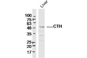 Lane 1: Mouse liver lysates probed with CTH Polyclonal Antibody, Unconjugated  at 1:300 overnight at 4˚C. (CTH anticorps)