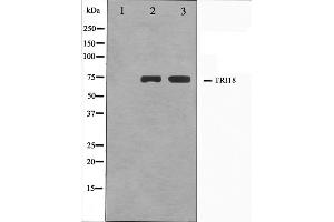 Western blot analysis on A549 and HuvEc cell lysate using TRI18 Antibody. (MID1 anticorps  (N-Term))