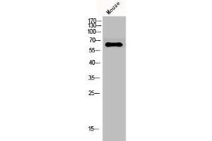 Western Blot analysis of mouse cells using GAD-65/67 Polyclonal Antibody