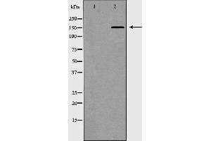 Western blot analysis of extracts of Jurkat, using MED1 antibody. (MED1 anticorps  (Internal Region))