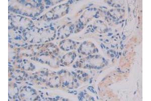 IHC-P analysis of Mouse Intestine Tissue, with DAB staining. (IL11RA anticorps  (AA 194-329))