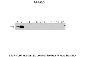 Lanes:   1: 40ng HIS-UBE2D1 protein 2: 40ng HIS-UBE2D2 protein 3: 40ng HIS-UBE2D3 protein 4: 40ng HIS-UBE2D4 protein 5: 40ng HIS-UBE2E1 protein 6: 40ng HIS-UBE2E2 protein 7: 40ng HIS-UBE2E3 protein 8: 40ng HIS-UBE2K protein 9: 40ng HIS-UBE2L3 protein 10: 40ng HIS-UBE2N protein 11: 40ng HIS-UBE2V1 protein 12: 40ng HIS-UBE2V2 protein. (UBE2D2 anticorps  (N-Term))