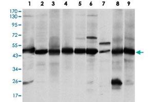 Western blot analysis of ASS1 monoclonal antibody, clone 2B10  against A-431 (1), RAJI (2), L1210 (3), MOLT4 (4), Jurkat (5), A-549 (6), NIH/3T3 (7), PC-12 (8) and COS-7 (9) cell lysate. (ASS1 anticorps)