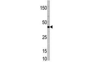 Image no. 1 for anti-Transcription Factor 7 (T-Cell Specific, HMG-Box) (TCF7) (N-Term) antibody (ABIN357291) (TCF7 anticorps  (N-Term))