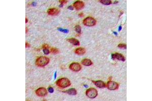 anti-Carbonic Anhydrase VIII (CA8) (Center) antibody