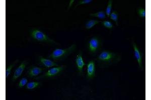 Immunofluorescent analysis of Hela cells using ABIN7173305 at dilution of 1:100 and Alexa Fluor 488-congugated AffiniPure Goat Anti-Rabbit IgG(H+L)