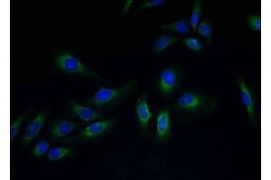 Immunofluorescent analysis of Hela cells using ABIN7173305 at dilution of 1:100 and Alexa Fluor 488-congugated AffiniPure Goat Anti-Rabbit IgG(H+L) (PVRIG anticorps  (AA 193-326))