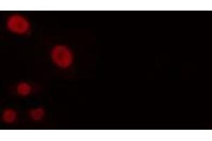 ABIN6274252 staining Hela cells by IF/ICC. (BUD31 anticorps  (N-Term))