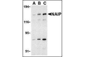 Western blot analysis of NAIP in PC-3 cell lysate with this product at (A) 0. (NAIP anticorps  (C-Term))