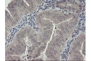 Image no. 7 for anti-RNA Binding Protein with Multiple Splicing (RBPMS) antibody (ABIN1500647)