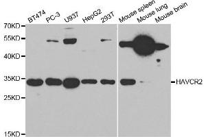 Western Blotting (WB) image for anti-Hepatitis A Virus Cellular Receptor 2 (TIM 3) antibody (ABIN1872939) (TIM3 anticorps)