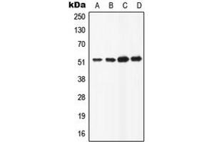 Western blot analysis of ATP6AP1 expression in HeLa (A), HepG2 (B), Raw264. (ATP6AP1 anticorps  (C-Term))