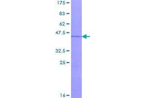 Image no. 1 for Regulator of G-Protein Signaling 13 (RGS13) (AA 1-159) protein (GST tag) (ABIN1317934)