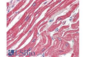 ABIN1590006 (5µg/ml) staining of paraffin embedded Human Heart. (MAPKAP Kinase 2 anticorps  (Internal Region))