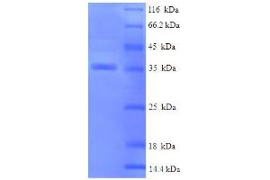 SDS-PAGE (SDS) image for Crystallin, alpha B (CRYAB) (AA 1-175), (full length) protein (His-SUMO Tag) (ABIN5709329)