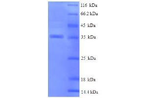 SDS-PAGE (SDS) image for Crystallin, alpha B (CRYAB) (AA 1-175), (full length) protein (His-SUMO Tag) (ABIN5709329)
