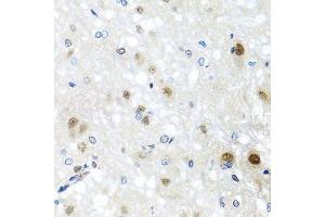 Immunohistochemistry of paraffin-embedded rat brain using SAFB2 antibody.