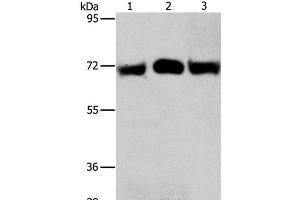 Western Blot analysis of Hela and A549 cell, Human liver cancer tissue using RPN1 Polyclonal Antibody at dilution of 1:350 (RPN1 anticorps)