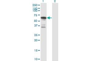 Western Blot analysis of ATE1 expression in transfected 293T cell line by ATE1 monoclonal antibody (M01), clone 2B6.