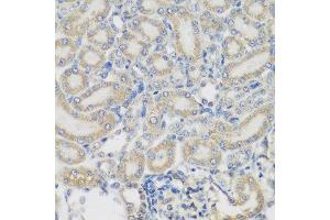 Immunohistochemistry of paraffin-embedded rat kidney using PYCR1 antibody at dilution of 1:200 (40x lens). (PYCR1 anticorps)