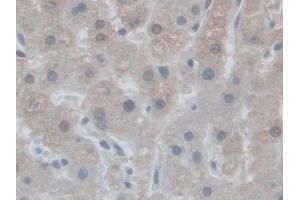 Detection of NOX5 in Human Liver Tissue using Polyclonal Antibody to Nicotinamide Adenine Dinucleotide Phosphate Oxidase 5 (NOX5)