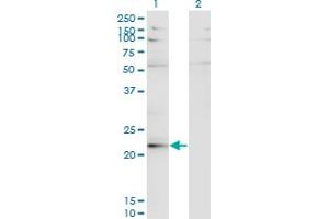 Western Blot analysis of LBX2 expression in transfected 293T cell line by LBX2 monoclonal antibody (M02), clone 3A5. (LBX2 anticorps  (AA 95-194))