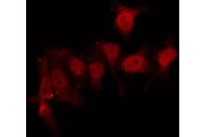 ABIN6275959 staining Hela by IF/ICC. (GPR152 anticorps  (N-Term))