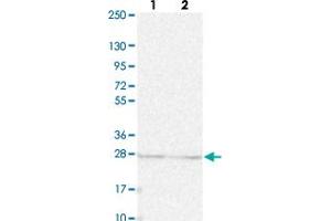 Western blot analysis of Lane 1: Human cell line RT-4 Lane 2: Human cell line U-251MG sp with KPNA1 polyclonal antibody  at 1:250-1:500 dilution. (KPNA1 anticorps)