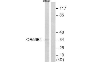 Western Blotting (WB) image for anti-Olfactory Receptor, Family 56, Subfamily B, Member 4 (OR56B4) (C-Term) antibody (ABIN1853150) (OR56B4 anticorps  (C-Term))