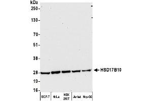 Western Blotting (WB) image for anti-Hydroxysteroid (17-Beta) Dehydrogenase 10 (HSD17B10) (AA 175-225) antibody (ABIN7449194)